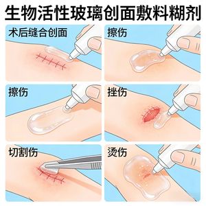 Apósito de Vidrio Bioactivo Yingchuang, Dispositivo Médico Clase II, Estimula la Angiogénesis para una Reparación de <span class=keywords><strong>Tejidos</strong></span> Más Rápida - Product Image 4