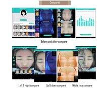 3 SPECTRUMS Mesin Analisis Kulit Portabel 2026 M9 Skin Analyzer Ai Magic Mirror Skin Analyzer Ai Intelligent Skin Analyzer