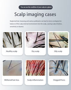 Massage des cheveux 3 en 1 analyseur de cuir chevelu de cheveux motiver la machine de croissance de collagène de cheveux traitement du cuir chevelu détecter l'<span class=keywords><strong>inflammation</strong></span> follicule - Product Image 4