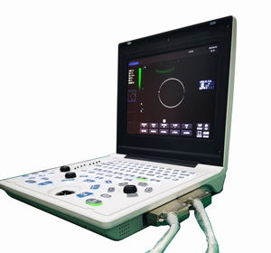 Échographe numérique complet de haute qualité et très demandé pour usage vétérinaire et scanner d'échographie de haute qualité pour vétérinaires - Product Image 3