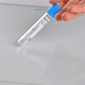 หลอดเก็บเลือดสุญญากาศแบบ Blue Top (โซเดียมซิเตรต) 1:9 ขนาด 13x75 มม. ปริมาตร 1-10 มล. ราคาขายส่ง - Product Image 1