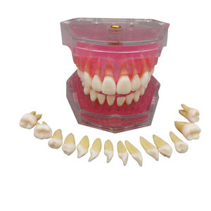 โมเดลฟันปลอมสำหรับการสอนแบบมาตรฐาน,โมเดลถอนฟันสำหรับนักเรียนแพทย์ - Product Image 5