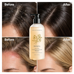 <span class=keywords><strong>Shampooing</strong></span> Végan <span class=keywords><strong>Anti</strong></span>-<span class=keywords><strong>Pelliculaire</strong></span> et Séborégulateur Effet Volume Marque Blanche au Thé Blanc, Gentiane et Camélia, Nettoyant et Rafraîchissant en Profondeur 400ml - Product Image 1