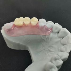 Productos dentales removibles parciales sin metales, dentaduras temporales, dientes acrílicos flexibles, <span class=keywords><strong>Valplast</strong></span>, el precio más bajo para agente dental - Product Image 2