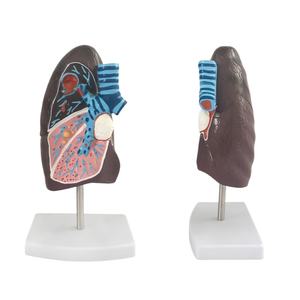 Modelo de pulmón patológico para fines de enseñanza médica - Product Image 5