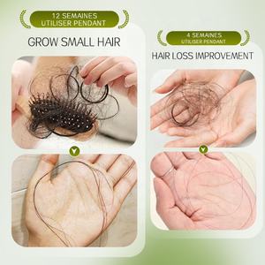 Siero Anticaduta per il Cuoio Capelluto con Estratti di Polygonum Multiflorum e Platycladus Stimola i Follicoli, Riduce la Caduta per un Capello Più Folto - Product Image 4