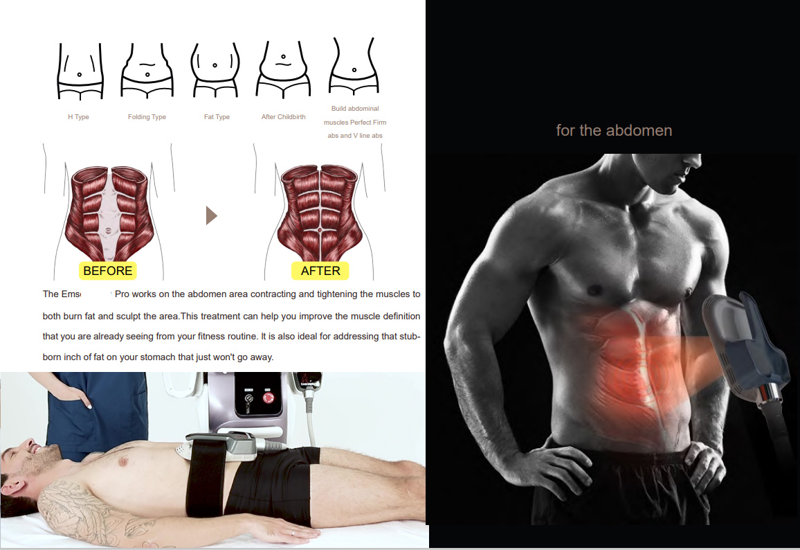 RF Emslim Neo Muscle Stimulator Machine Electromagnetic Shockwave Body Sculpt