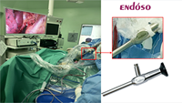 CE Approved 4K Medical Optical Rigid Endoscope Fluorescence Laparoscope for Laparoscopy Arthroscopy Hysteroscopy ENT Surgery