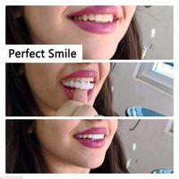Dents Smart Dentiers Imitation Bretelles Temporaire Faux Dents Couverture Sourire Parfait Confortable Fit Dentier Facettes Kit