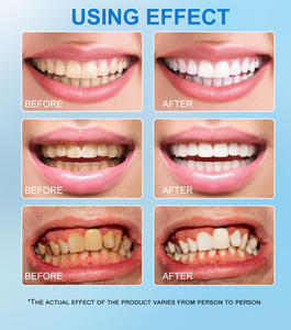 Enjuague Bucal Blanqueador con Sabor a Menta, Nutritivo, Sensación de Boca Realmente Limpia, Enjuague Bucal para Eliminar el <span class=keywords><strong>Mal</strong></span> <span class=keywords><strong>Aliento</strong></span> y Cuidado Bucal - Product Image 4