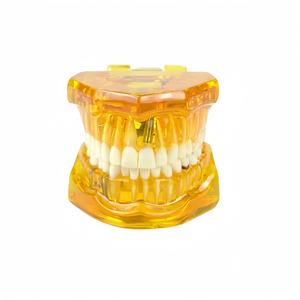 Protesi dentale, plastico dentale modello denti, restauro con impianto - Product Image 4