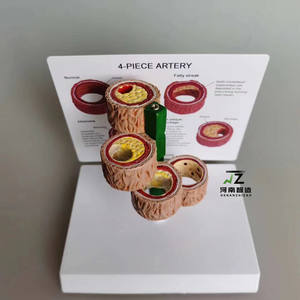 แบบจำลองการสาธิตลิ่มเลือดอุดตันในหลอดเลือดแดงของมนุษย์ 4 ชิ้น สำหรับการศึกษาทางวิทยาศาสตร์การแพทย์ แบบจำลองโรคในมนุษย์ - Product Image 4