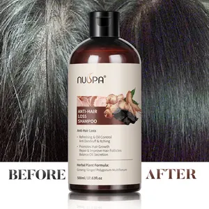 Täglicher Gebrauch Haarpflege Anti-Haarausfall-Shampoo Fördert die Haars tärke Dicke Ingwer Kräuter shampoo