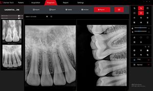 Trung Quốc Nhà sản xuất <span class=keywords><strong>Xray</strong></span> kỹ thuật số X-Ray nha khoa x Ray cảm biến cho Nha khoa/môi trường/phòng thí nghiệm - Product Image 2