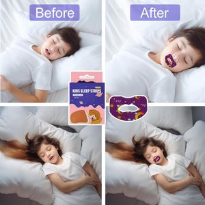Cinta Bucal Anti Ronquidos Ce, Sin Látex, Adhesiva, Selladora de Labios, Tiras H para Dormir Mejor, Cinta Bucal para una Mejor Respiración Nasal - Product Image 2