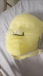 V-face Shape Whitening <strong>Plaster</strong> Support <strong>Plaster</strong> Bandage Witch <strong>Facial</strong> 5D Mummy Mask Use with Water Oxygen Pen - Product Image 4