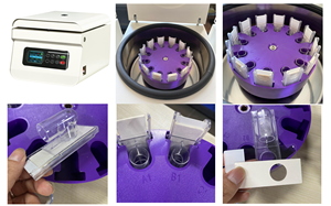 Kostprijs 4000Rpm Lage Snelheid Celuitstrijkje (Cytospin) Klinische <span class=keywords><strong>Centrifuge</strong></span> Laboratorium <span class=keywords><strong>Centrifuge</strong></span> Machine - Product Image 2