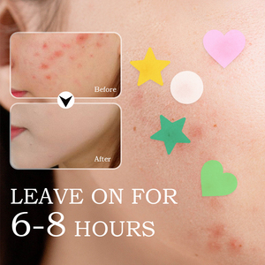Venta al por mayor en forma de corazón hidrocoloide acné espinillas parches estrella Color para cara hidratante cúrcuma maquillaje cubierta punto colorido - Product Image 6