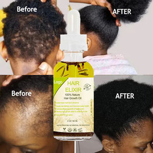 Лидер продаж, органическое масло для волос с листьями розмарина, частная марка, высококачественный экстракт розмарина, уход за кожей головы, масло для роста волос - Product Image 1