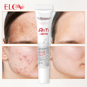 Crème anti-acné et anti-taches à l'extrait de plantes Beauty Host, vente en gros, soin du visage personnalisé, crème anti-acné pour le visage - Product Image 5