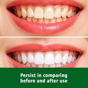 Poudre dentifrice blanchissante OEM Pearl Bright White |   50 ml, formule au <span class=keywords><strong>bicarbonate</strong></span> <span class=keywords><strong>de</strong></span> <span class=keywords><strong>soude</strong></span> pour un <span class=keywords><strong>nettoyage</strong></span> en profondeur et un blanchiment - Product Image 5