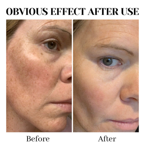 Suero de Cúrcuma con Ácido Kójico de Marca Privada, Suero Corrector de Manchas Oscuras, Suero Facial Iluminador Antienvejecimiento para un Tono de Piel Uniforme - Product Image 5