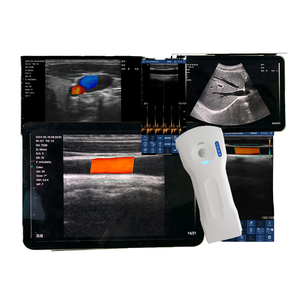 Ecografo Portatile Elettrico SURESULT D3Ultra per Imaging del Seno - Caratterizzazione delle Lesioni, Valutazione degli Impianti e Guida alla Biopsia - Product Image 1