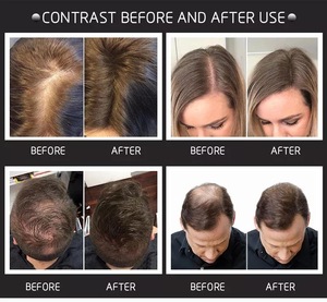 3 Languages Private Label 27.5G <strong>Hair</strong> Loss Treatment <strong>Fibre</strong> Fully Keratin <strong>Hair</strong> Building Fiber <strong>Powder</strong> - Product Image 6