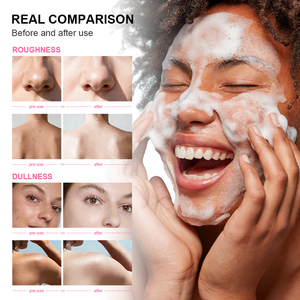 <span class=keywords><strong>Sapone</strong></span> Solido Artigianale alla Fragola 100g - Trattamento Schiarente Anti-<span class=keywords><strong>Acne</strong></span>, Pulizia dei Pori, Controllo del Sebo <span class=keywords><strong>per</strong></span> Viso e Corpo - Product Image 4