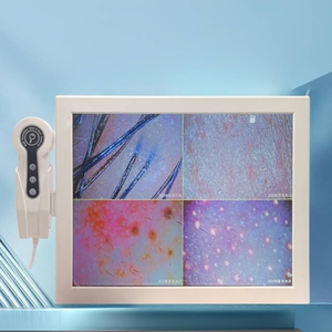 Màn hình HD kỹ thuật số 15 inch sử dụng Máy phân tích da và tóc giúp bạn phân tích da và phân tích Máy quét đóng băng cố định - Product Image 3