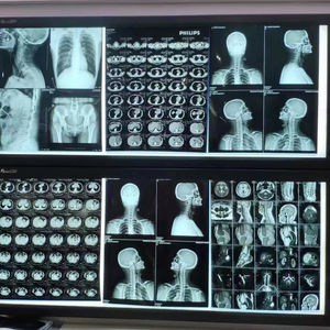 Mavi mürekkep püskürtmeli tıbbi kuru Film CT <span class=keywords><strong>DR</strong></span> MRI X Ray mavi şeffaf Film - Product Image 5