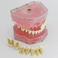 Modèle d'étude d'implant dentaire avec dents amovibles – Modèle standard pour l'enseignement médical (CE/ISO)