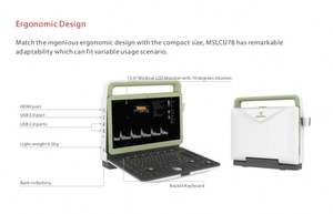 أدوات الموجات فوق الصوتية الطبية Medsinglong Color-Ecocardiografo محمولة 4d 5d - Product Image 3