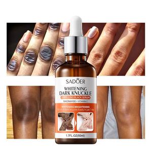 Suero Blanqueador para Nudillos Oscuros de Marca Privada, Aclara los Dedos, Elimina la Oscuridad de Codos, Rodillas, Articulaciones de los Dedos, Aceite Esencial Blanqueador Corporal - Product Image 1