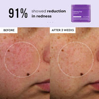 Perawatan Kulit Label Pribadi Perilla Ceramide Hyaluronic Acid Toner Lembaran Penenang dan Pelembap, Pembersih Wajah, Masker Wajah