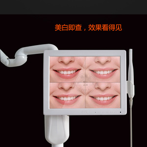 Máquina de Blanqueamiento Dental Neutro Vimel con Endoscopio 220V 17kg, Soporte de Piso para Uso en Salón de Belleza Dental - Product Image 5