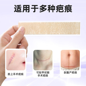 Parches médicos para cicatrices de hiperplasia poscesareína, gel de silicona para reparación quirúrgica de la tiroides y eliminación de cicatrices, y - Product Image 3