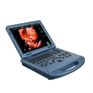 UCD-50L ดิจิตอลเต็มรูปแบบ 3D/4D/5D แล็ปท็อปอัลตราซาวนด์สี Doppler เครื่องวินิจฉัยอัลตราโซนิก