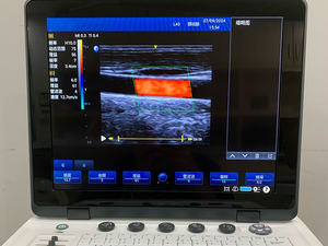 C9PRO 15 "peralatan <span class=keywords><strong>Ultrasound</strong></span> klinik Doppler warna dengan DICOM Potable mesin <span class=keywords><strong>Ultrasound</strong></span> untuk perut OB ginekologi bagian kecil - Product Image 3