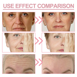 Bálsamo Multifuncional Jaysuing <span class=keywords><strong>Collagen</strong></span> <span class=keywords><strong>Wrinkle</strong></span> Bounce para Mulheres, Redutor de Poros, <span class=keywords><strong>Anti</strong></span>-Rugas, Hidratante e Firmador para Olhos, Pescoço e Rosto - Product Image 3