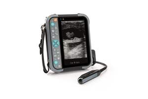 Máquina de ultrasonido de tamaño de palma de la mano, escáner de ultrasonido, máquina de diagnóstico - Product Image 2