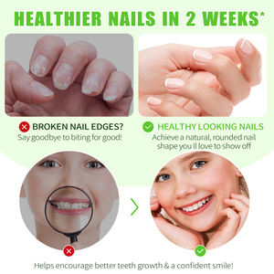 ALIVER 15ml Quick Dry Thumb Sucking Deterrent <strong>Nail</strong> <strong>Polish</strong> Treatment <strong>Nail</strong> Care <strong>Nail</strong> <strong>Biting</strong> Prevention <strong>Stop</strong> <strong>Nail</strong> <strong>Biting</strong> for Kids - Product Image 5