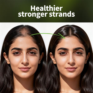 Trattamento Personalizzato 50ml per Caduta e Crescita dei Capelli, Idratante e Riparatore, Spray per la Cura dei Capelli a Base <span class=keywords><strong>di</strong></span> Erbe Organiche - Product Image 5