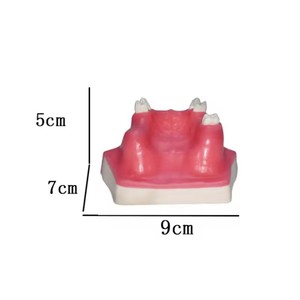 Modèle de communication médecin-patient pour l'implantation dentaire, aide pédagogique orale de classe I pour le lifting du sinus maxillaire, dents manquantes - Product Image 5