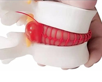 Ayuda para enseñanza biológica, anómicas vértebras lumbares, humanos, degenerativas, modelo de columna vertebral, Color blanco