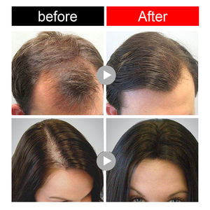 EELHOE-Barra de champú de jengibre para el crecimiento del cabello, jabón calmante para el cuero cabelludo, pérdida de rotura, prevención, barra de champú sólida para el cabello - Product Image 3