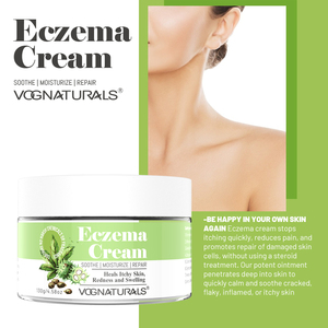 Crema Herbal <span class=keywords><strong>para</strong></span> Eczema de Marca Privada, Hidratante, Nutritiva <span class=keywords><strong>para</strong></span> la Piel, Tratamiento <span class=keywords><strong>para</strong></span> <span class=keywords><strong>Dermatitis</strong></span> y Psoriasis, Sin Esteroides, Calmante y Anti-Picazón - Product Image 4