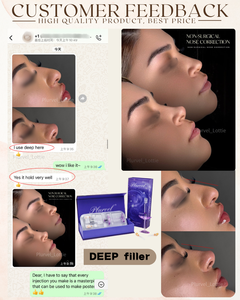 Formule avancée 1 ml de produit de comblement dermique HA réticulé pour le remodelage du visage et la correction <span class=keywords><strong>des</strong></span> rides profondes - Product Image 5
