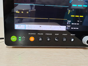 SUN-603S <span class=keywords><strong>ECG</strong></span> 멀티 파라미터 의료 수동물 생체 신호 장치 가격 - Product Image 4