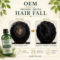Serum Herbal Rosemary Vegan Alami untuk Perawatan Kulit Kepala dan Rambut, Minyak Esensial untuk Pertumbuhan Rambut Rusak, Perawatan Menutrisi 100ml Grosir